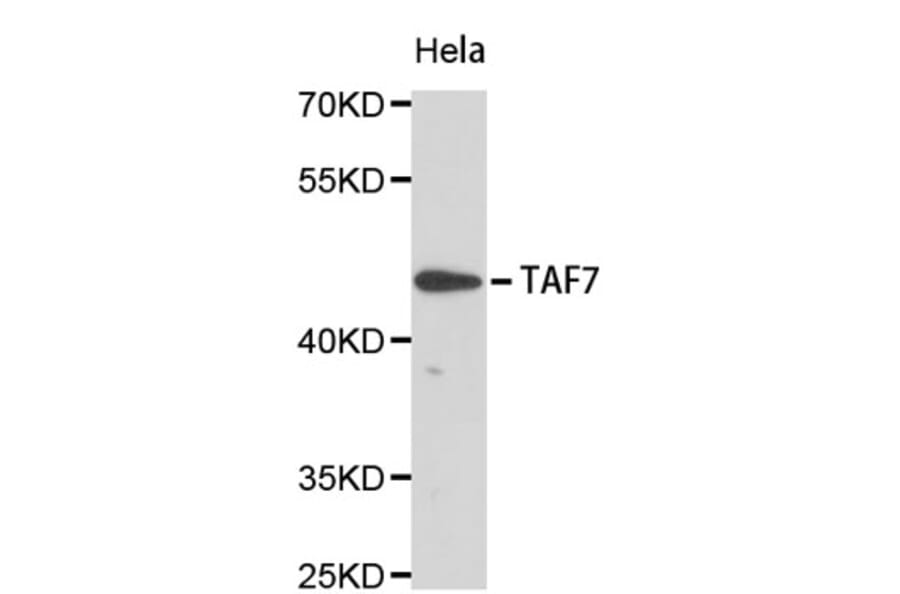 Western Blot - Anti-TAF7 Antibody (A8906) - Antibodies.com