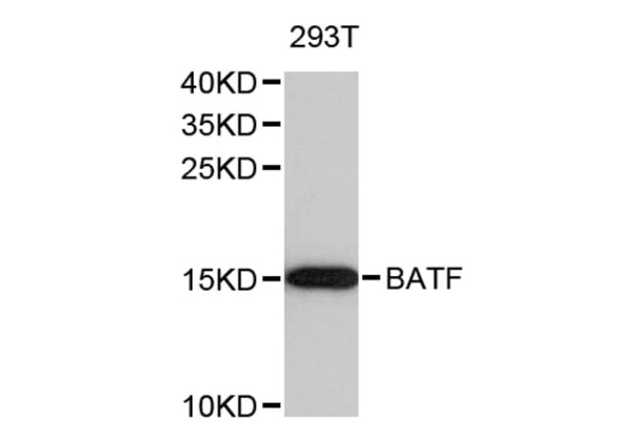 Western Blot - Anti-BATF Antibody (A8907) - Antibodies.com