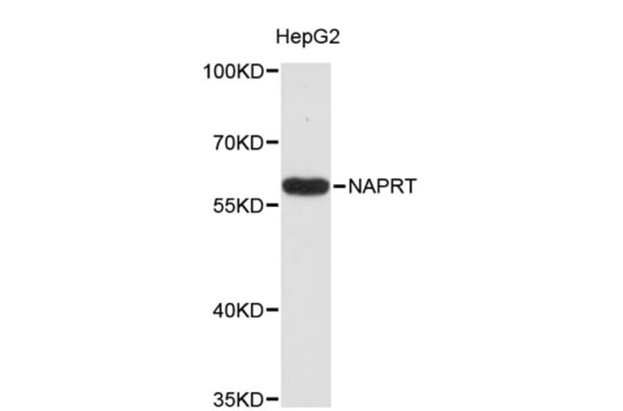 Western Blot - Anti-NAPRT Antibody (A8911) - Antibodies.com