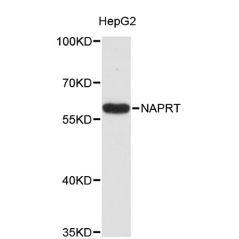 Western Blot - Anti-NAPRT Antibody (A8911) - Antibodies.com