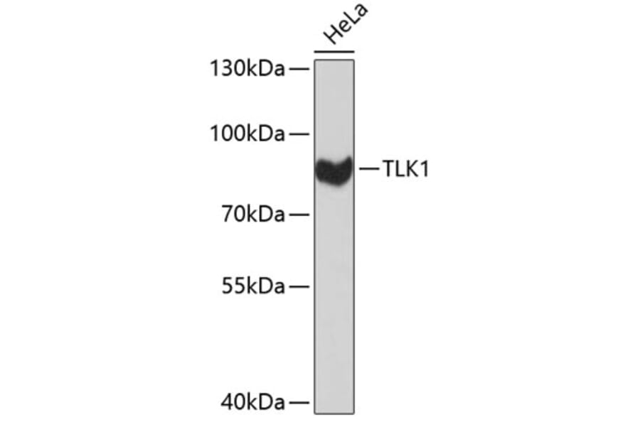 Western Blot - Anti-TLK1 Antibody (A8913) - Antibodies.com