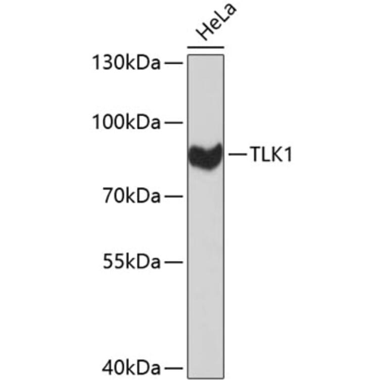 Western Blot - Anti-TLK1 Antibody (A8913) - Antibodies.com