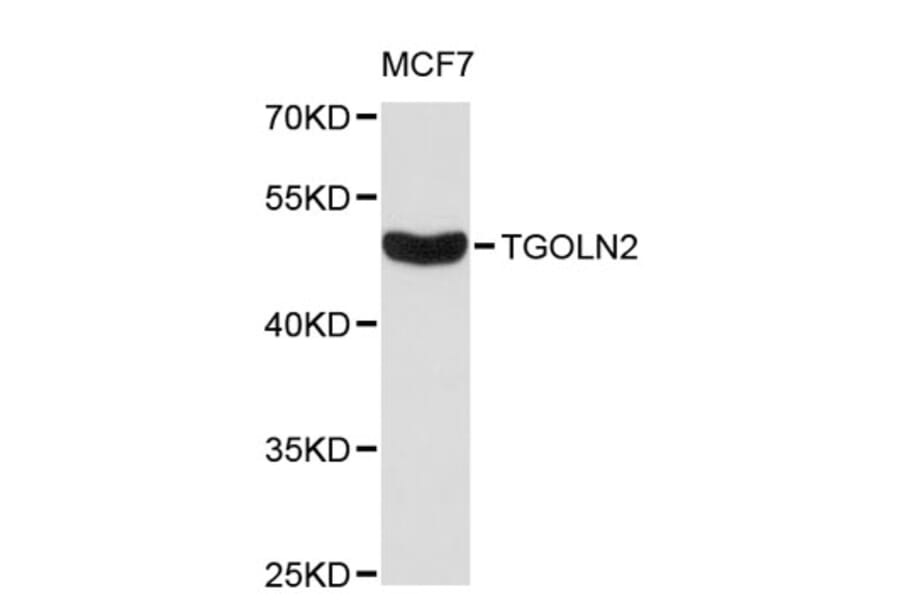 Western Blot - Anti-TGOLN2 Antibody (A8914) - Antibodies.com