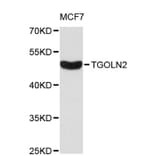 Western Blot - Anti-TGOLN2 Antibody (A8914) - Antibodies.com