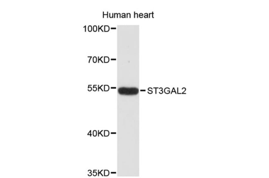 Western Blot - Anti-ST3GAL2 Antibody (A8917) - Antibodies.com
