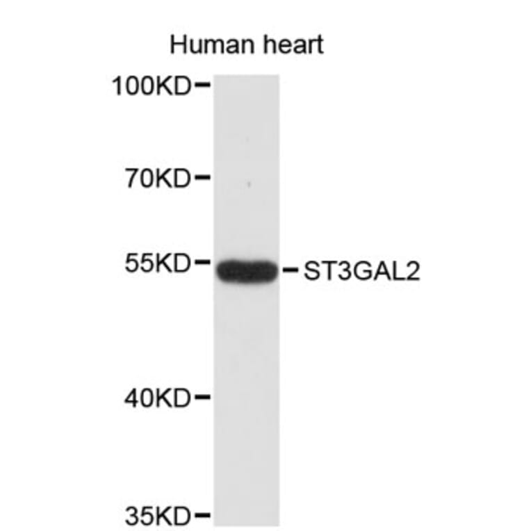 Western Blot - Anti-ST3GAL2 Antibody (A8917) - Antibodies.com