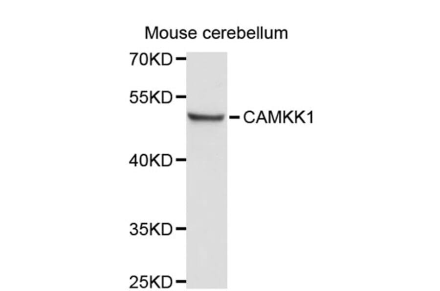 Western Blot - Anti-CAMKK1 Antibody (A8920) - Antibodies.com