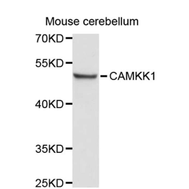 Western Blot - Anti-CAMKK1 Antibody (A8920) - Antibodies.com