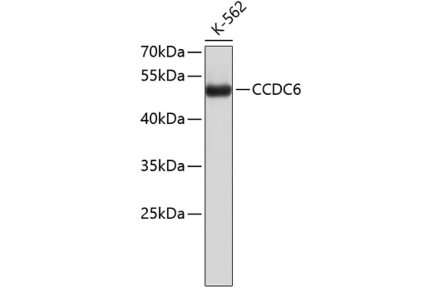Western Blot - Anti-CCDC6 Antibody (A8928) - Antibodies.com