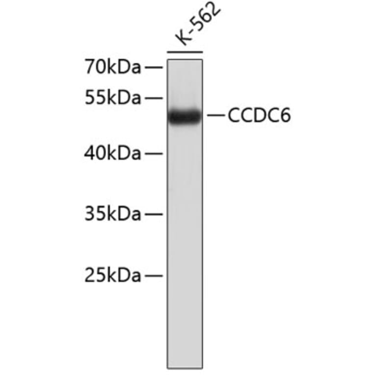 Western Blot - Anti-CCDC6 Antibody (A8928) - Antibodies.com