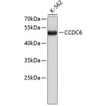 Western Blot - Anti-CCDC6 Antibody (A8928) - Antibodies.com