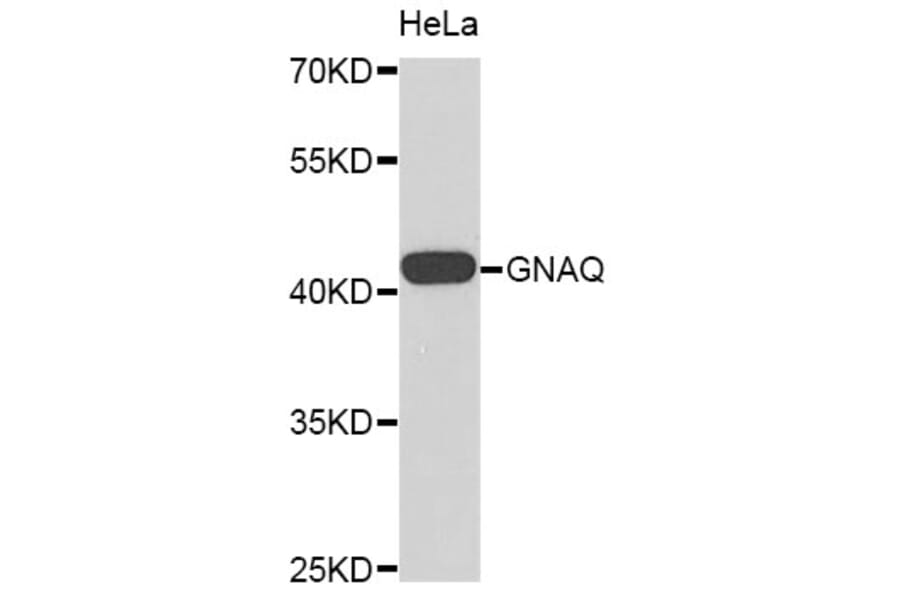 Western Blot - Anti-GNAQ Antibody (A8945) - Antibodies.com