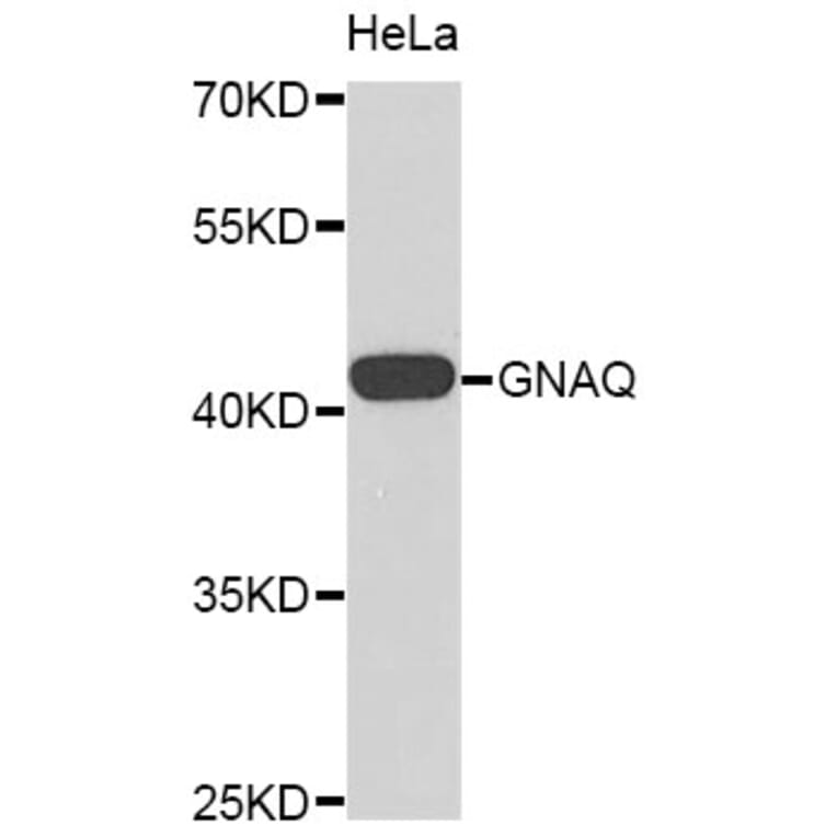 Western Blot - Anti-GNAQ Antibody (A8945) - Antibodies.com