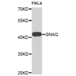 Western Blot - Anti-GNAQ Antibody (A8945) - Antibodies.com