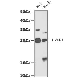 Western Blot - Anti-HV1 Antibody (A10579) - Antibodies.com
