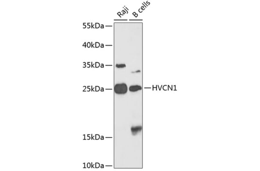 Western Blot - Anti-HV1 Antibody (A10579) - Antibodies.com