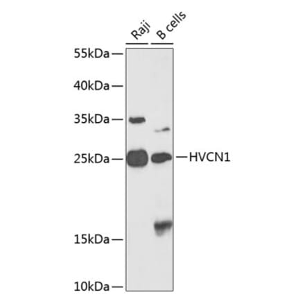 Western Blot - Anti-HV1 Antibody (A10579) - Antibodies.com