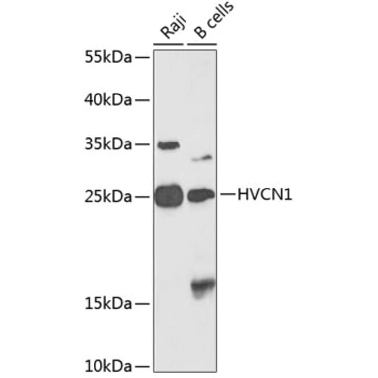 Western Blot - Anti-HV1 Antibody (A10579) - Antibodies.com