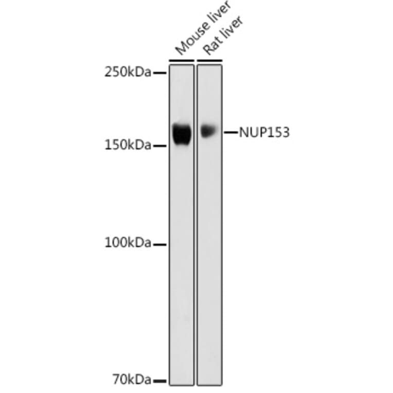 Western Blot - Anti-Nup153 Antibody (A10581) - Antibodies.com