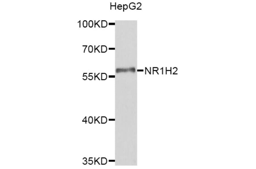 Western Blot - Anti-NR1H2 Antibody (A8979) - Antibodies.com