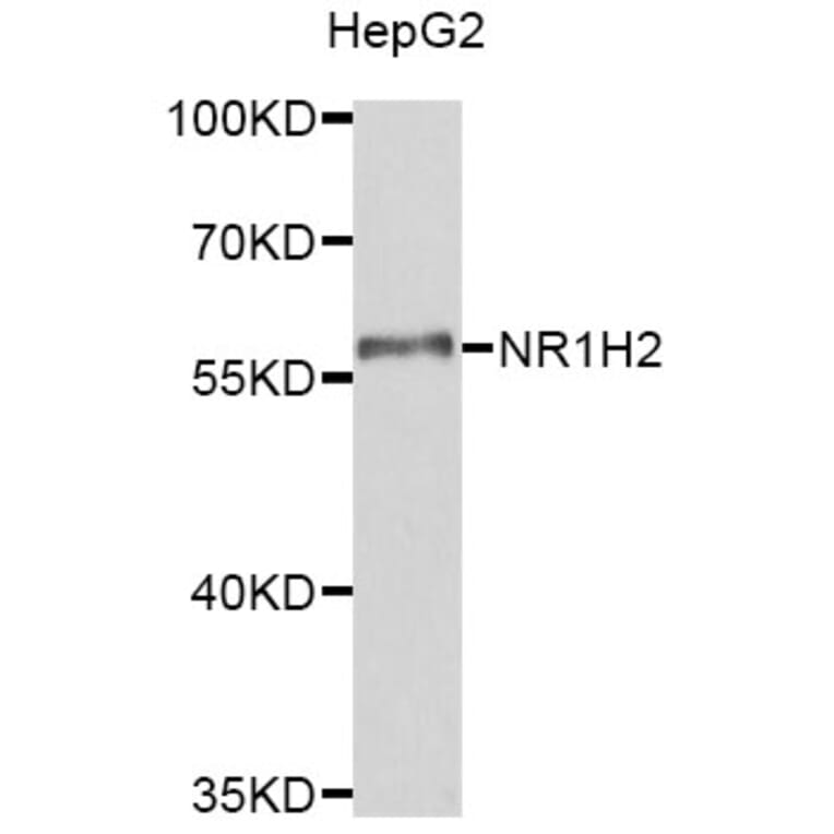 Western Blot - Anti-NR1H2 Antibody (A8979) - Antibodies.com