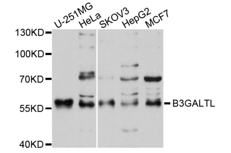Western Blot - Anti-B3GALTL Antibody (A9014) - Antibodies.com