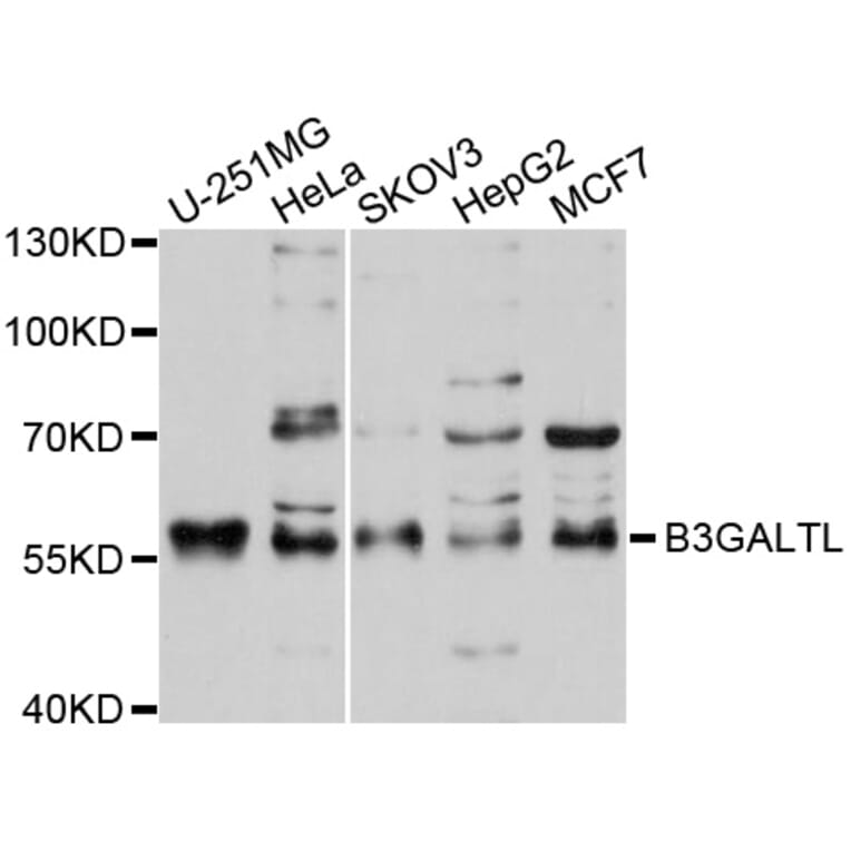 Western Blot - Anti-B3GALTL Antibody (A9014) - Antibodies.com