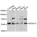 Western Blot - Anti-B3GALTL Antibody (A9014) - Antibodies.com