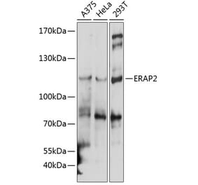 Western Blot - Anti-ERAP2 Antibody (A10596) - Antibodies.com