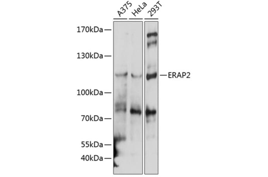 Western Blot - Anti-ERAP2 Antibody (A10596) - Antibodies.com