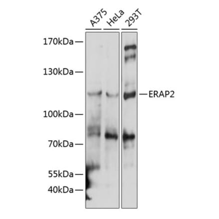 Western Blot - Anti-ERAP2 Antibody (A10596) - Antibodies.com