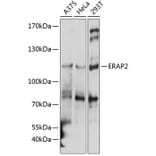 Western Blot - Anti-ERAP2 Antibody (A10596) - Antibodies.com