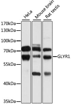 Western blot analysis of extracts of various cell lines, using Anti-GLYR1 Antibody (A9046) at 1:1,000 dilution.
Secondary antibody: Goat Anti-Rabbit IgG (H+L) (HRP) (AS014) at 1:10,000 dilution.
Lysates / proteins: 25µg per lane.
Blocking buffer: 3% non-fat dry milk in TBST.
Detection: ECL Basic Kit (RM00020).
Exposure time: 5s.