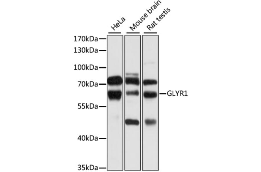 Western Blot - Anti-GLYR1 Antibody (A10604) - Antibodies.com
