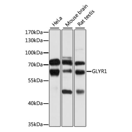 Western Blot - Anti-GLYR1 Antibody (A10604) - Antibodies.com