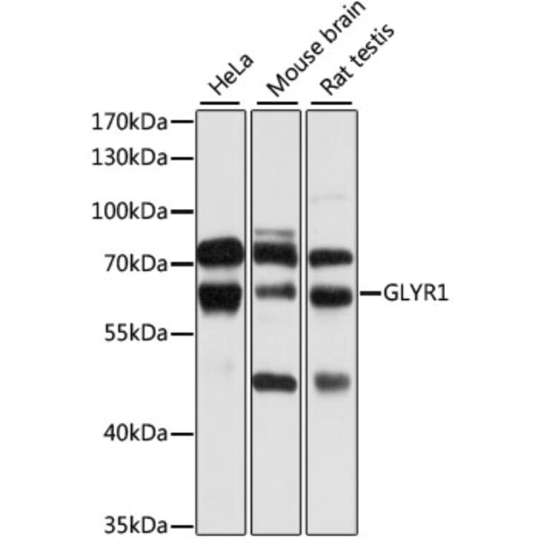 Western Blot - Anti-GLYR1 Antibody (A10604) - Antibodies.com