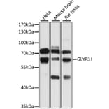 Western Blot - Anti-GLYR1 Antibody (A10604) - Antibodies.com