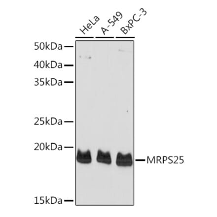 Western Blot - Anti-MRPS25 Antibody (A10612) - Antibodies.com