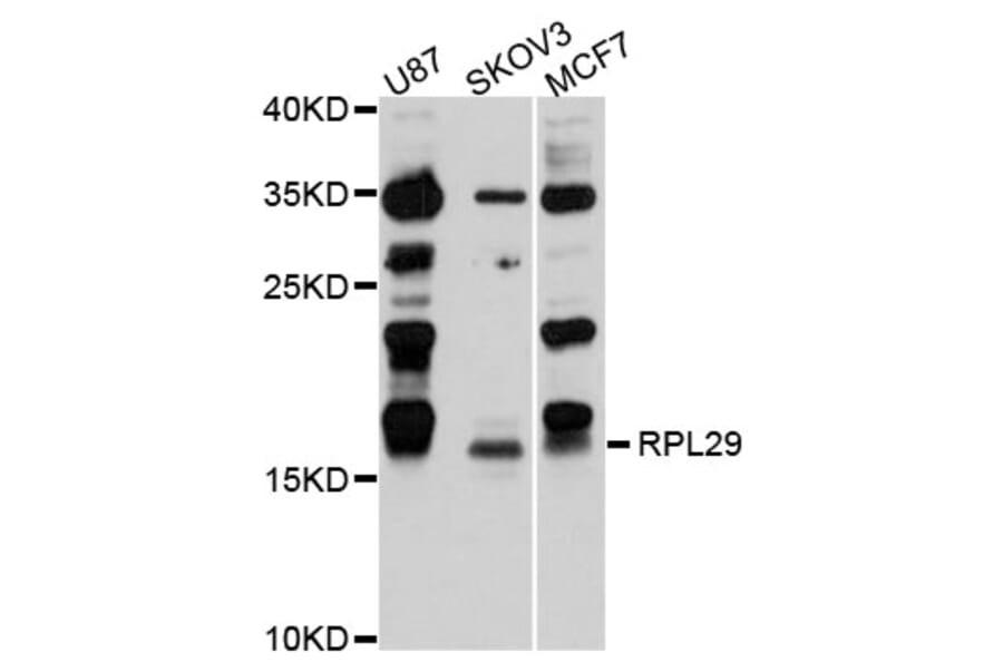 Western Blot - Anti-RPL29 Antibody (A9138) - Antibodies.com