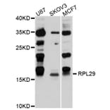 Western Blot - Anti-RPL29 Antibody (A9138) - Antibodies.com