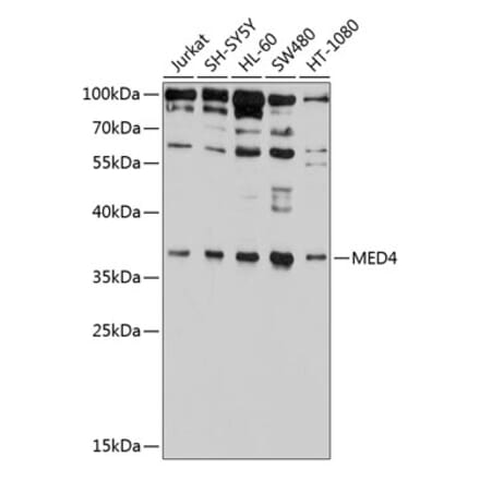 Western Blot - Anti-MED4 Antibody (A10627) - Antibodies.com