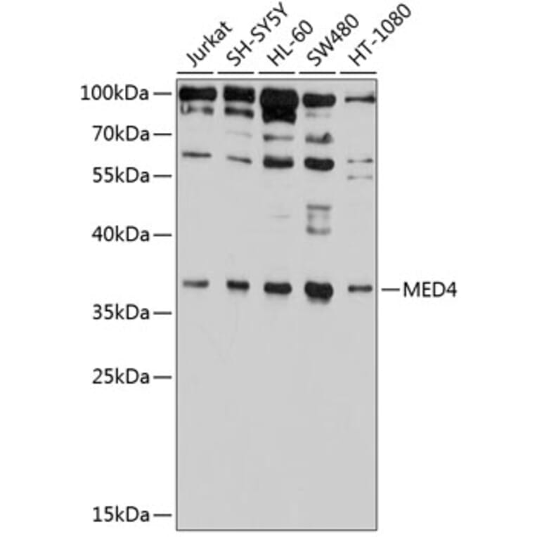 Western Blot - Anti-MED4 Antibody (A10627) - Antibodies.com