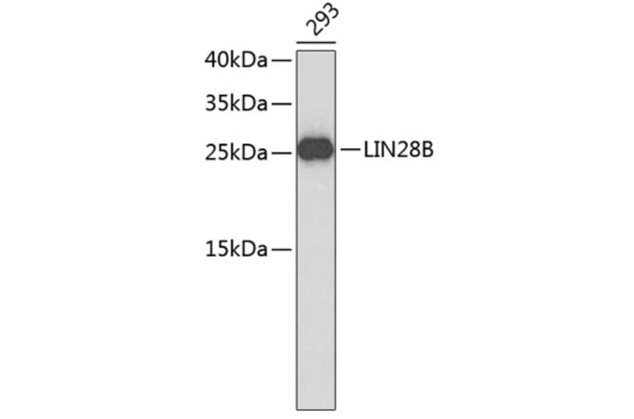 Western Blot - Anti-LIN28B Antibody (A9167) - Antibodies.com