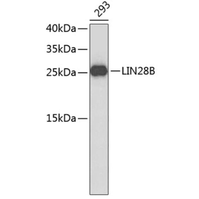 Western Blot - Anti-LIN28B Antibody (A9167) - Antibodies.com