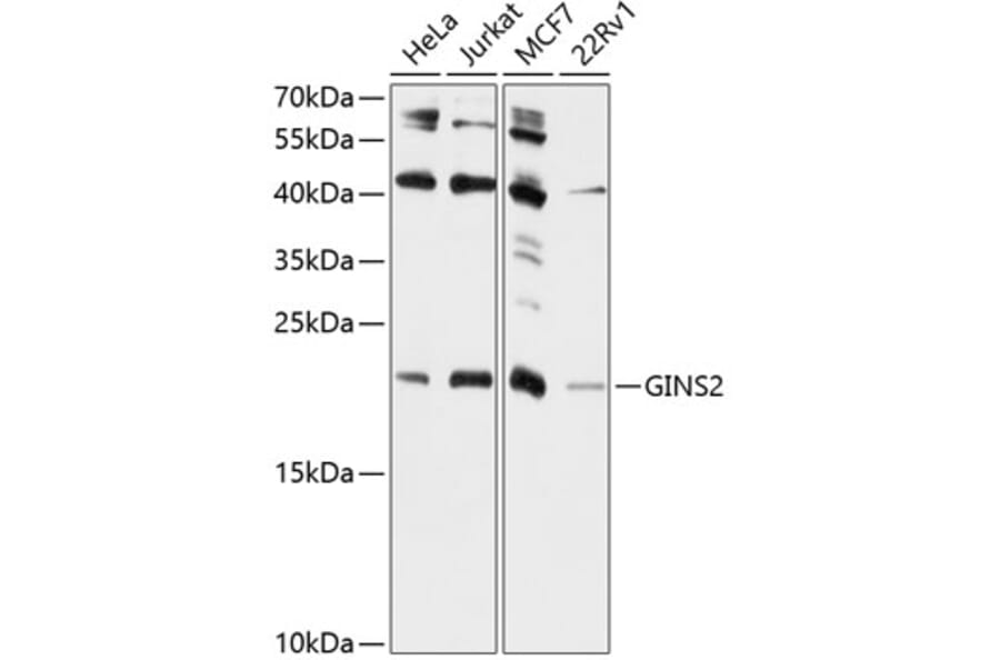 Western Blot - Anti-GINS2 Antibody (A10635) - Antibodies.com