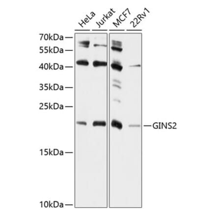 Western Blot - Anti-GINS2 Antibody (A10635) - Antibodies.com