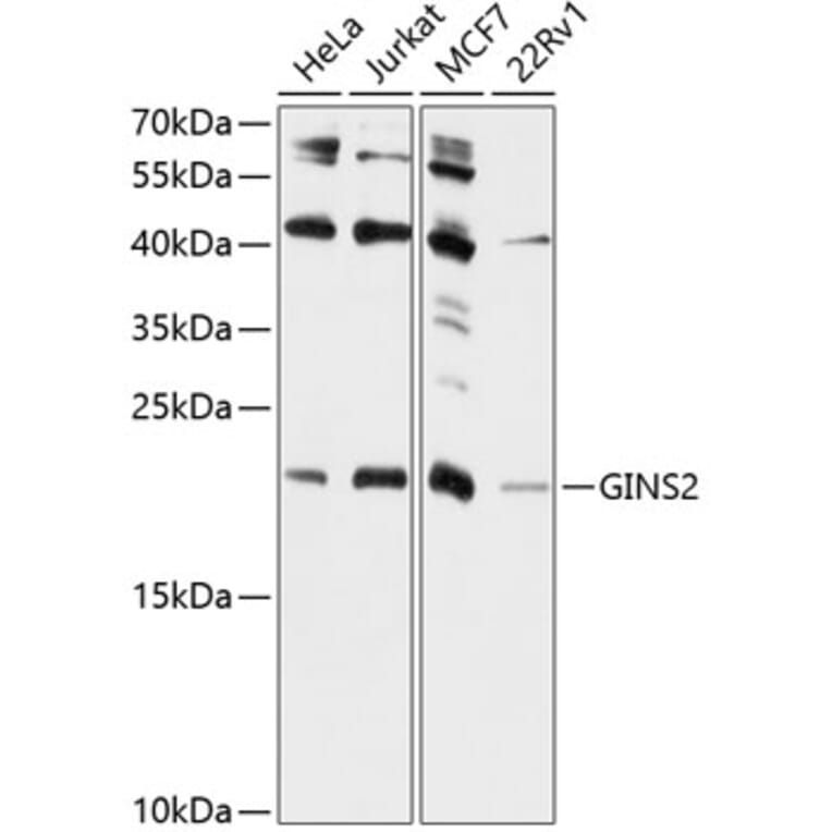 Western Blot - Anti-GINS2 Antibody (A10635) - Antibodies.com