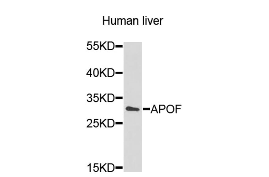 Western Blot - Anti-APOF Antibody (A9198) - Antibodies.com