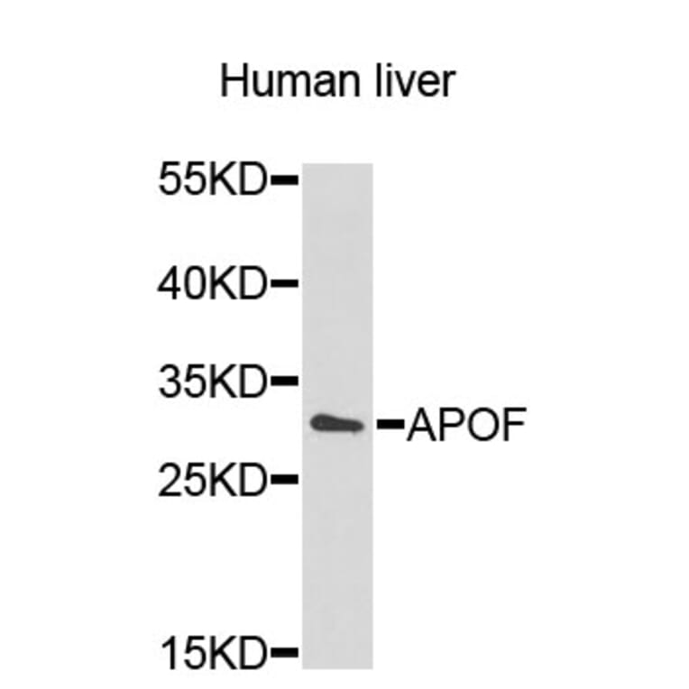 Western Blot - Anti-APOF Antibody (A9198) - Antibodies.com