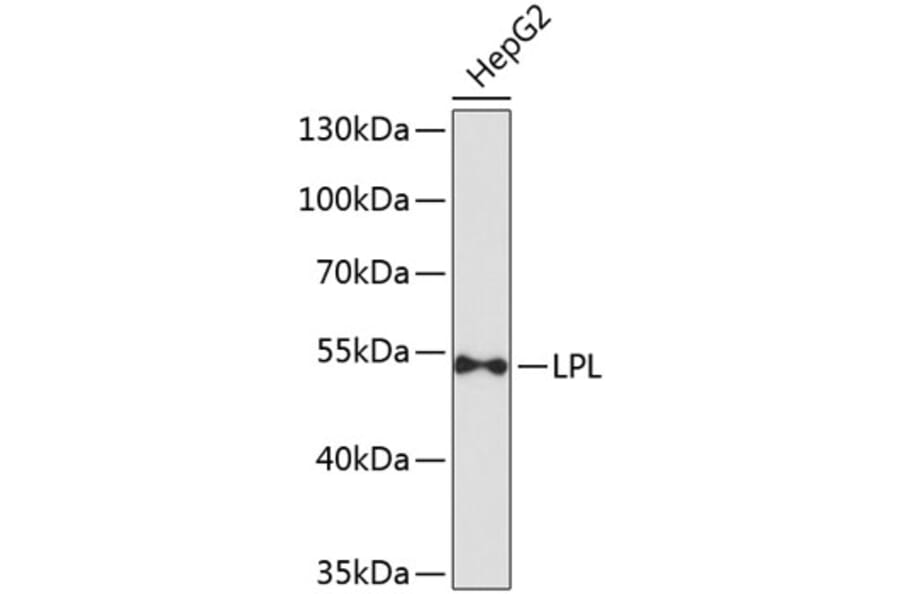 Western Blot - Anti-LPL Antibody (A9228) - Antibodies.com